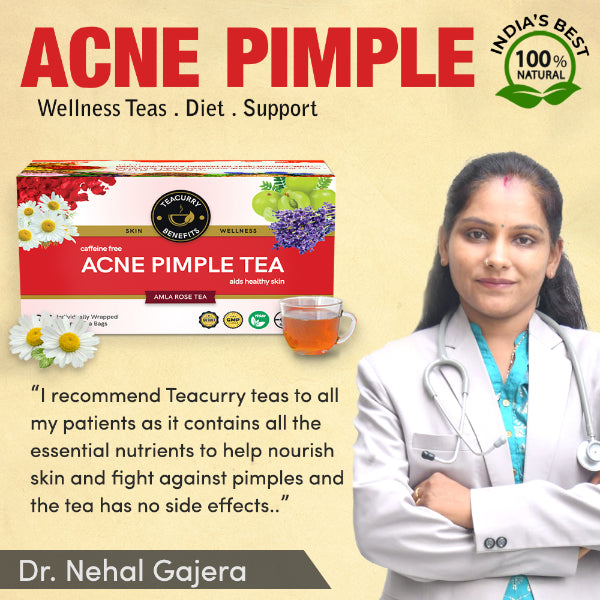 Teacurrty Acne Tea /Helps In Pimples, Cysts, Pustules & Nodules-100g(30 Tea Bags)