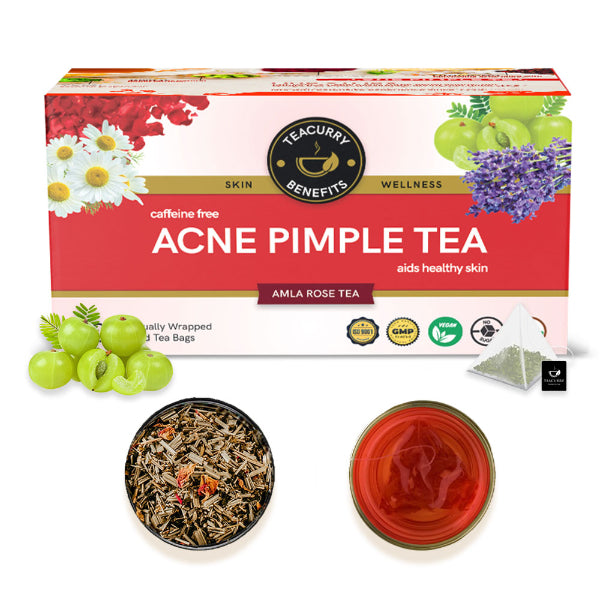 Teacurrty Acne Tea /Helps In Pimples, Cysts, Pustules & Nodules-100g(30 Tea Bags)